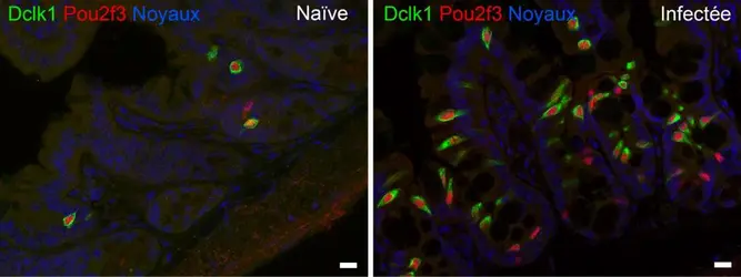 Cellules tuft avant et après une infection parasitaire - crédits : Institut de génomique fonctionnelle