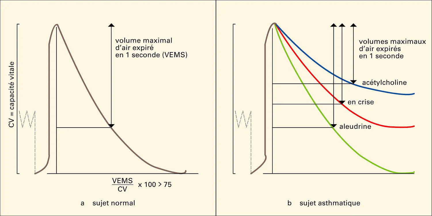 Enregistrements au cours de l'épreuve de spirographie