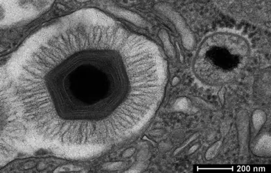 Mimivirus - crédits : IGS, CNRS UMR 7256