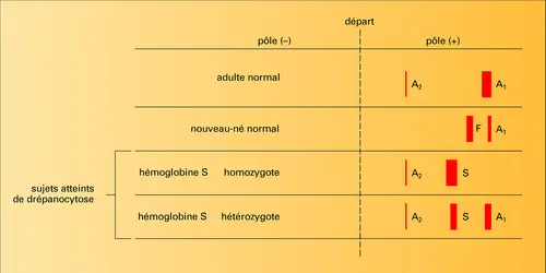 Hémoglobine : électrophorèse - crédits : Encyclopædia Universalis France