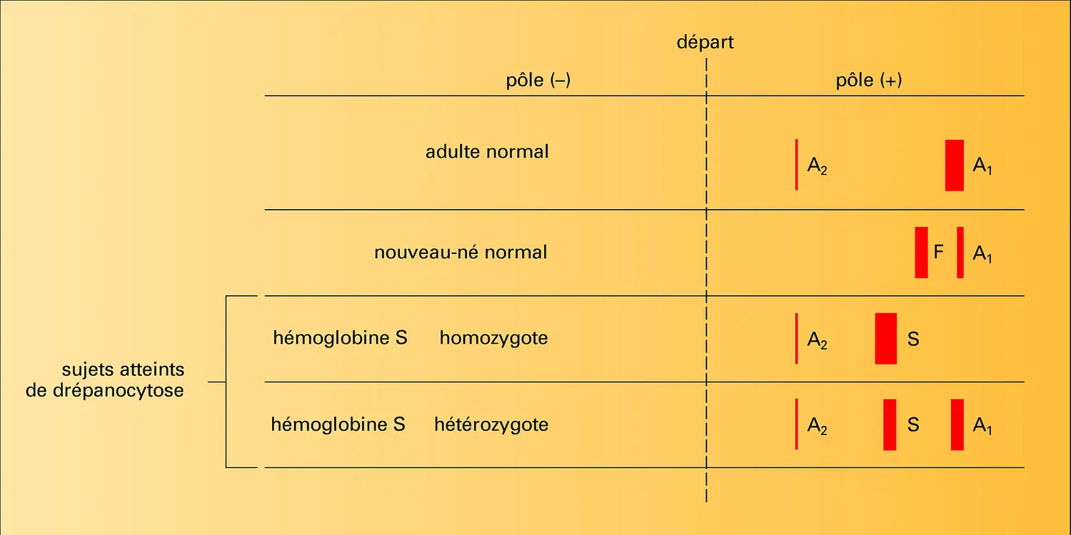 Hémoglobine : électrophorèse