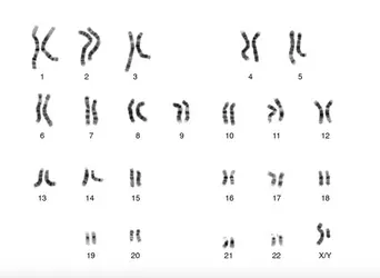 Caryotype humain normal - crédits : Courtesy NHGRI/ genome.gov