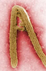 Virus de la fièvre de Marburg - crédits : Frederick Murphy/ Centers for Disease Control/ flickr
