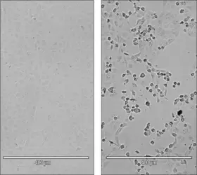 Effet toxique (cytopathogène) du virus SARS-CoV-2 - crédits : Yannick Simonin